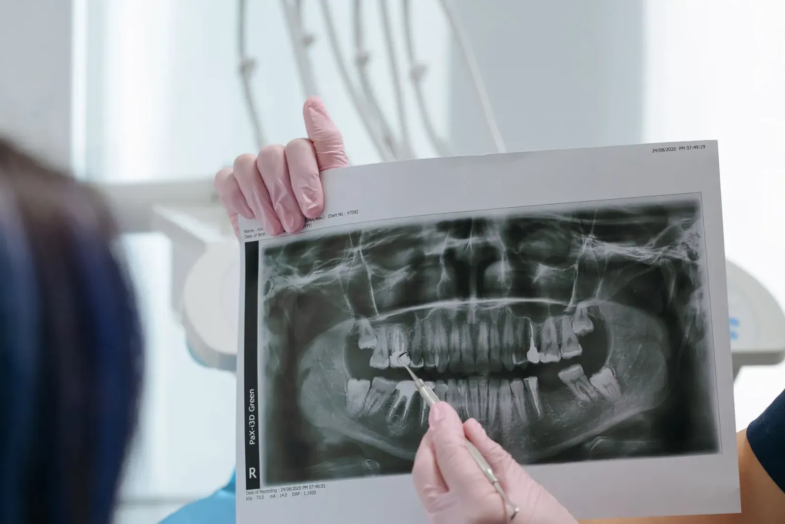 Dentist holding up a panoramic dental X-ray showing the full upper and lower jaw
