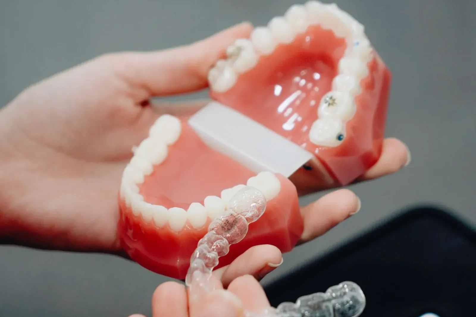 Clear removable retainer held beside the dental model it was made from, worn after braces
